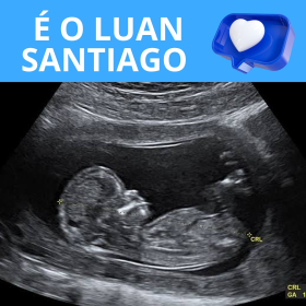 clique aqui