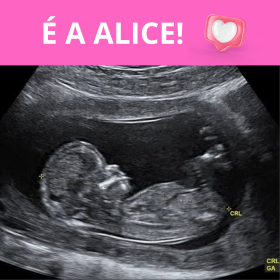 CLIQUE AQUI SE ACHA QUE É MENINA