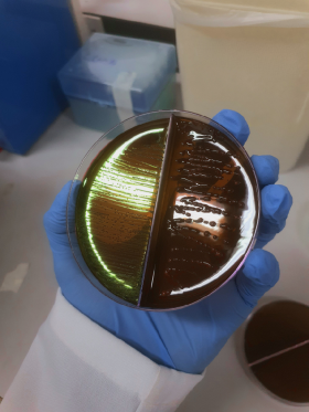 E.coli+K.pneumoniae_LuizFellipe - Luiz Fellipe Rangel