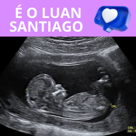 clique aqui