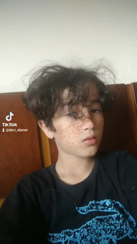 DAVI